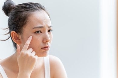 κηλίδες στο πρόσωπο πρόληψη & τροποι αντιμετωπισης