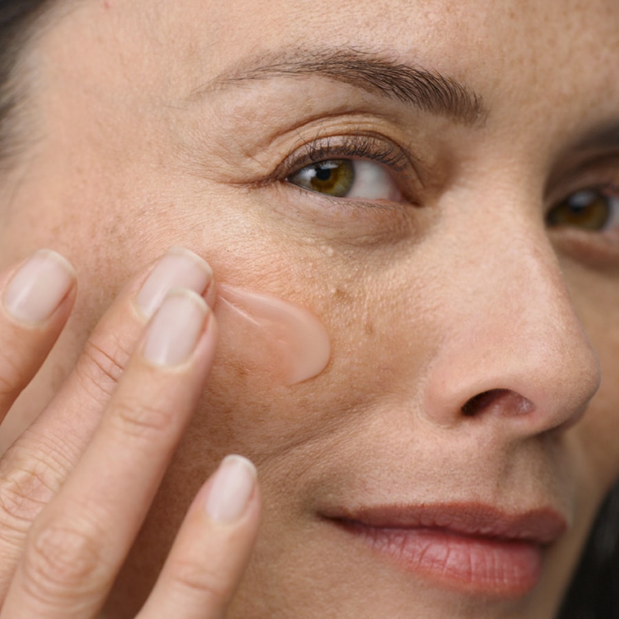 ωριμο δερμα