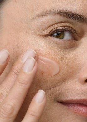 ωριμο δερμα