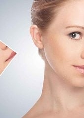 Τι είναι η κυστική ακμή και πώς να την αντιμετωπίσετε
