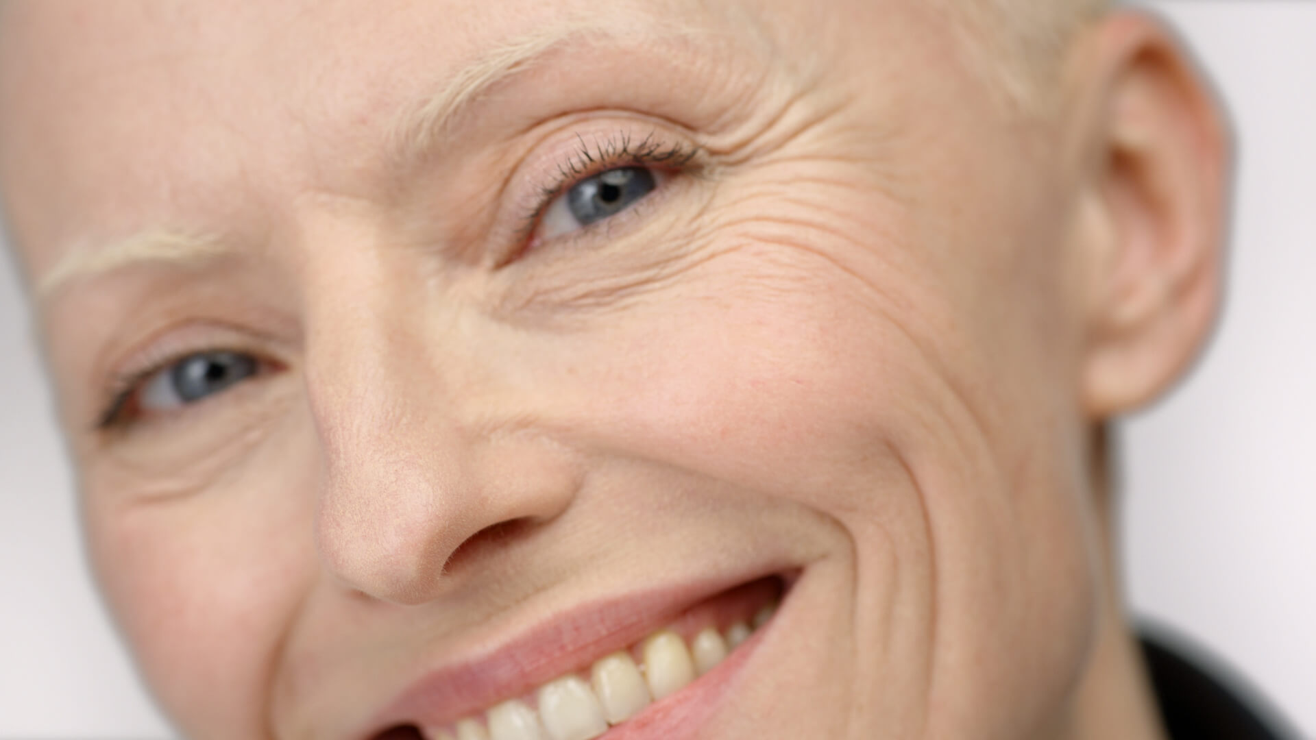 μπορει να γερασει το δερμα απο τη ρυπανση?