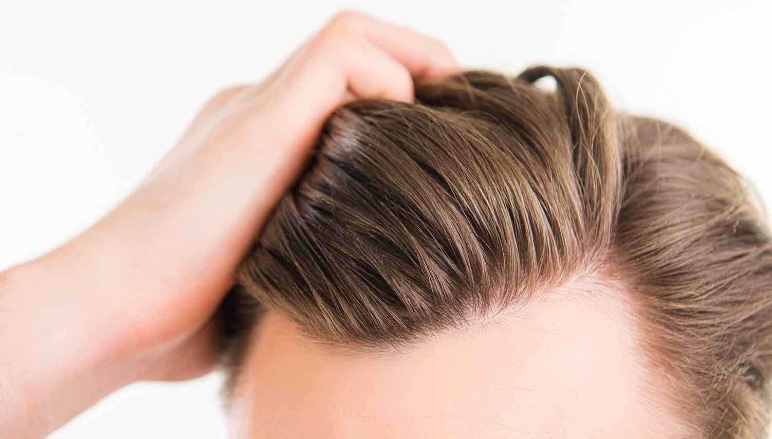 κολλωδης πιτυριδα