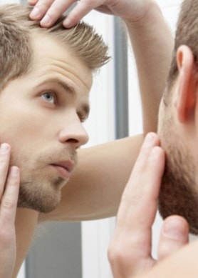 ανδρικη τριχοπτωση