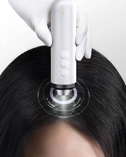 scalp pro