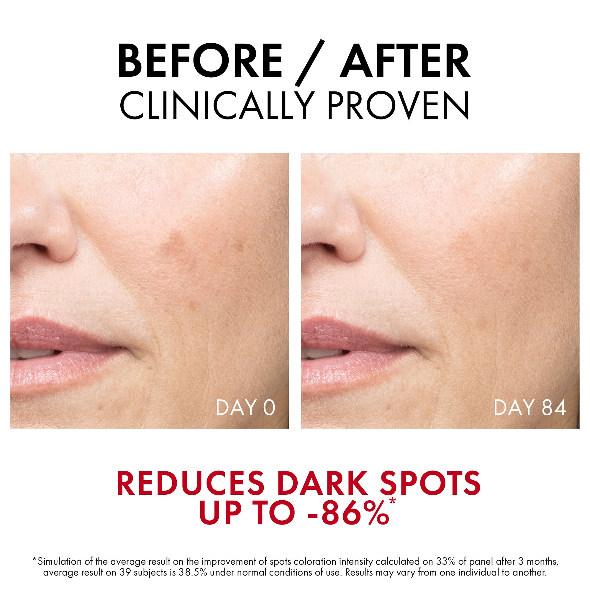 Liftactiv Pigment Specialist B3 Serum πριν μετα