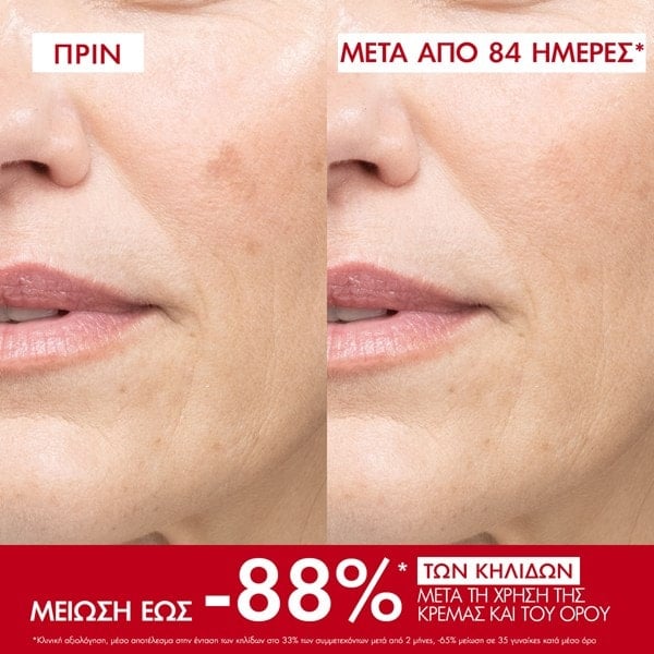 Liftactiv Pigment Specialist B3 αποτελέσματα