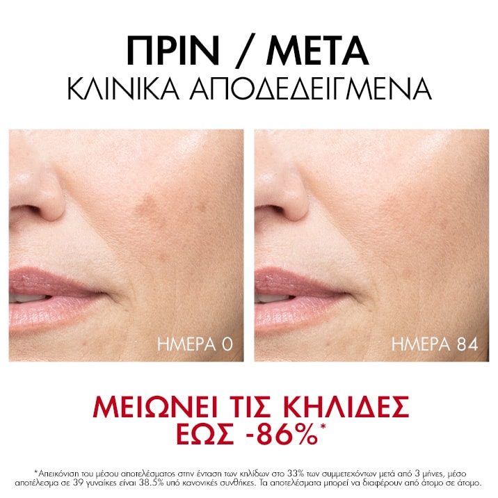 Liftactiv Pigment Specialist B3 αποτελέσματα