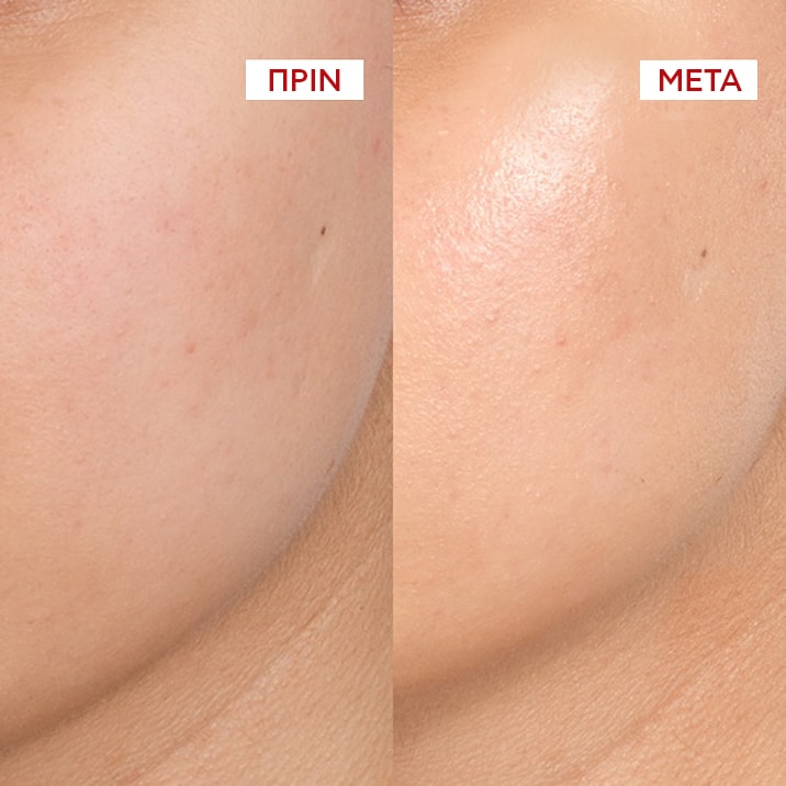 Liftactiv Collagel πριν μετα