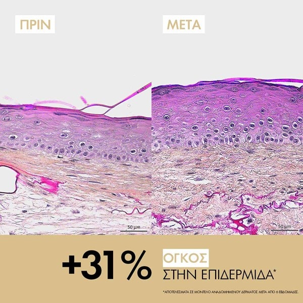 NEOVADIOL Refill Longevity Κρέμα για Αναδόμηση Προσώπου Πριν & Μετά