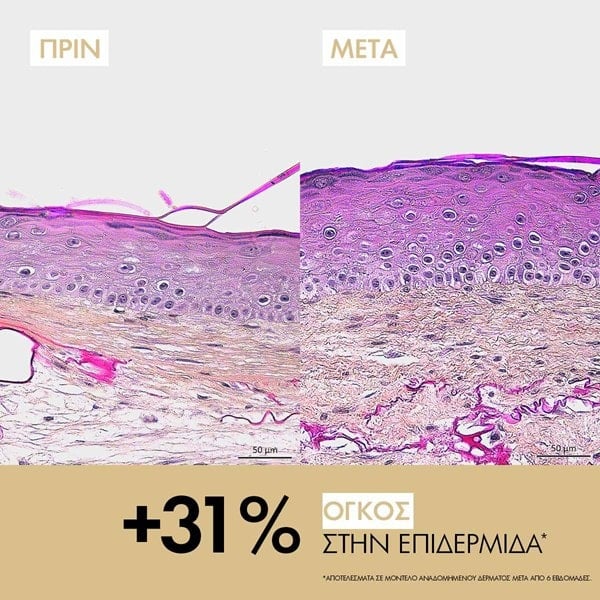 Neovadiol Longevity Cream +3% όγκος στην επιδερμίδα