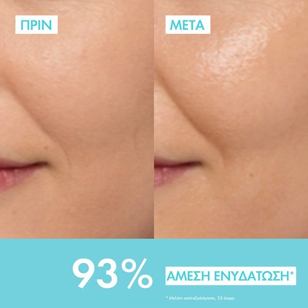 Mineral 89 πριν και μετά